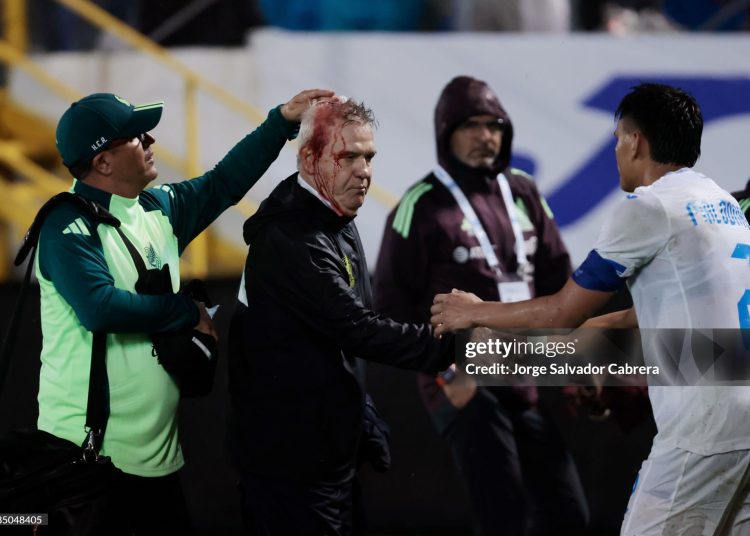 Javier Aguirre, Head Coach of Mexico, leaves the pitch with a head injury due to a bottle thrown by Honduras' fans during the CONCACAF Nations League match between Honduras and Mexico at General Francisco Morazan Stadium on November 15, 2024 in San Pedro Sula, Honduras.  (Photo by Jorge Salvador Cabrera/Getty Images)